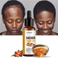 Batana Oil Hair Revival Elixir™